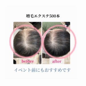 増毛エクステ５００本