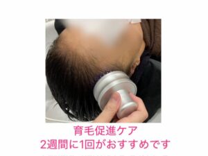 育毛促進ケア
