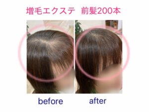 増毛エクステ前髪２００本